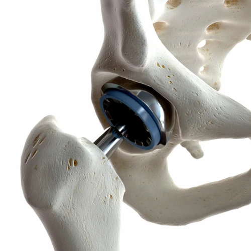 Cirugía de rodilla artroscópica en CDMX con el Dr. Luis Miguel Minero Rabatte