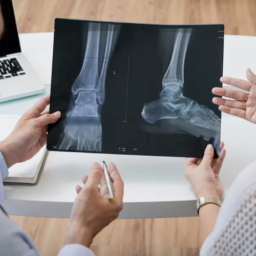 Reemplazo articular de cadera en CDMX con Dr. Luis Miguel Minero Rabatte
